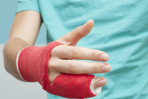How to Tell If Your Finger Is Broken New Health Advisor