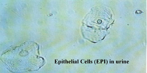 What are epithelial cells?
