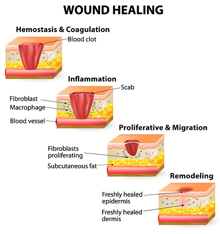 healing wound process tissue skin stages scar care inflammation maturation hemostasis heal formation nursing know injury cuts repair processes regeneration